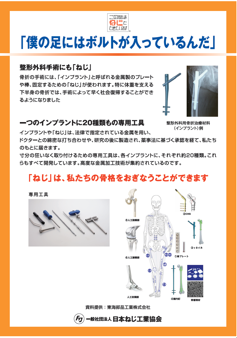 Explanation board #14.png