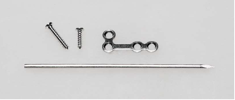 In vivo surgical product (prototype) made of magnesium material 2023-07-03 16.40.41.png